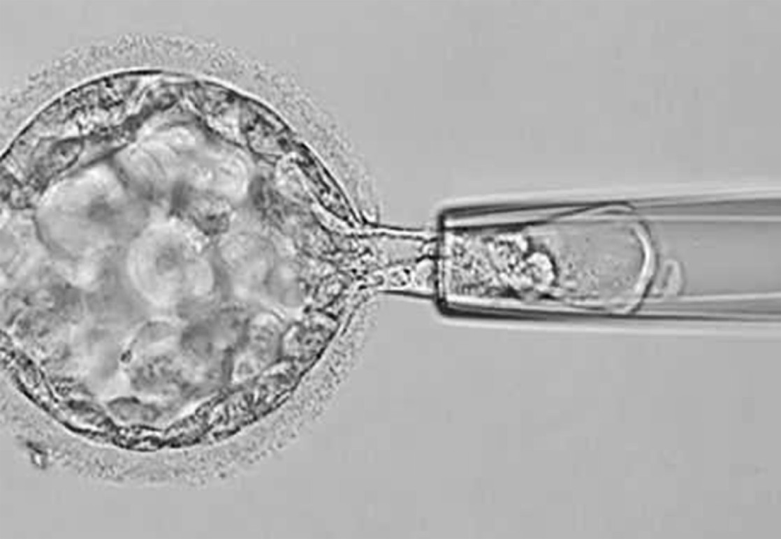 This is the way the biopsy is carried out. As you see a small cell sample is taken from the outer cell mass – the future placenta. No biopsy is taken form the inner cell mass- the future embryonic body